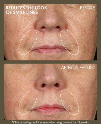 Plantscription Active Wrinkle Correction Serum, 1 oz.