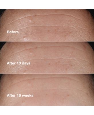 Smart Clinical Repair™ Wrinkle Correcting Serum, 1 oz.