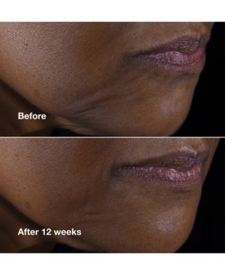 Smart Clinical Repair Lifting Face + Neck Cream, 2.54 oz.