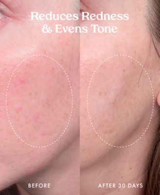 Star Bright Vitamin C Discoloration Correcting Serum, 1 oz.