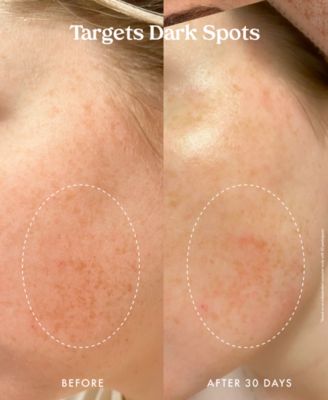 Star Bright Vitamin C Moisturizer, 1.7 oz.