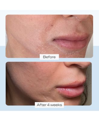 Ultra Repair Cream, 2-oz.