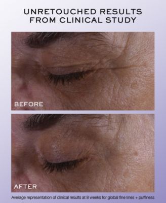 R&eacute;nergie H.C.F. Triple Serum Eye, 0.67 oz.