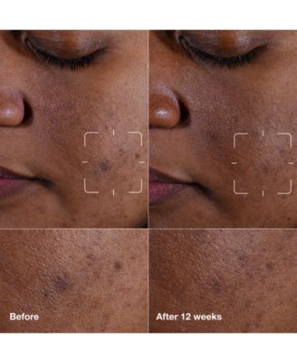 Even Better Clinical Dark Spot Clearing Serum with Vitamin C, 50 ml