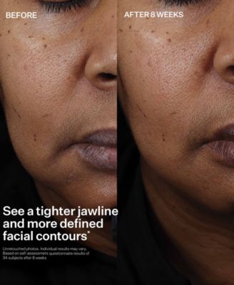 Peptight Face Lift Serum, 1 oz.