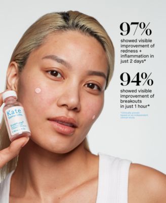 EradiKate Acne Treatment, 1 oz.