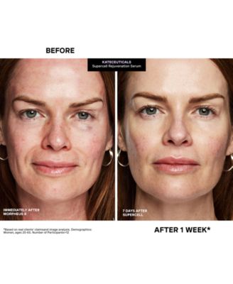 KateCeuticals SuperCell Rejuvenation Serum, 1 oz.