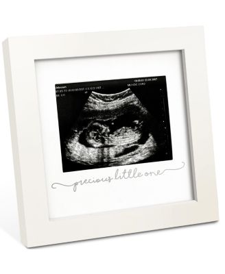 Solo Baby Sonogram Picture Frame, Modern Ultrasound Picture Frames, Pregnancy Announcements Sonogram Frame