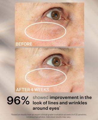 Peptight 360 Tightening Eye Serum, 1 oz