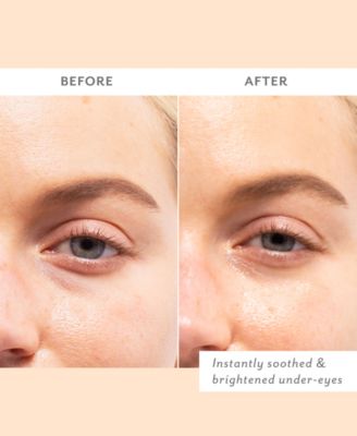 Skin Remedy Soothing Eye Gels, 5-Pk.