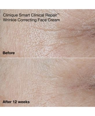 Wrinkle-Fighting Routine Skin Care Gift Set