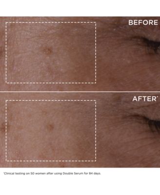 4-Pc. Double Serum & Super Restorative Skincare Set