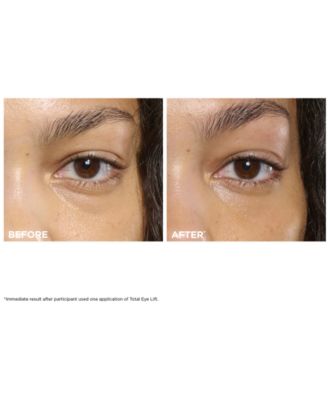 3-Pc. Total Eye Lift Set