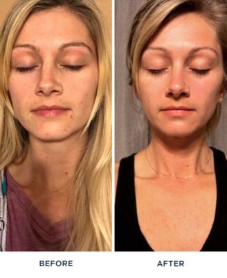 FR&Eacute; Renew Me Bakuchiol Anti-Wrinkle Serum, 1oz.