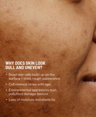 Advanced Microdermabrasion Face Exfoliator