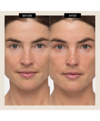 MyoLift TriWave Microcurrent Facial Device