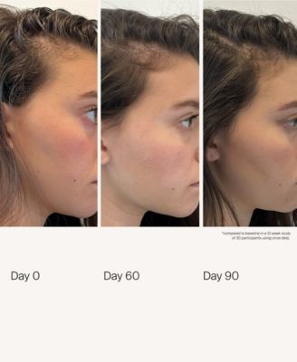 Scalp Care Density Serum, 1.7 oz.