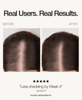 Red LED Light therapy Hair Growth Cap