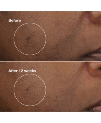 3-Pc. Brightening Routine: Mini Even Better Skincare Kit