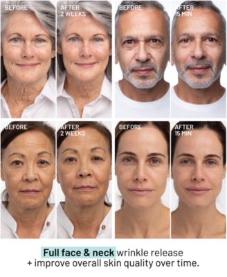 Wrinkle Release Serum, 1 oz.