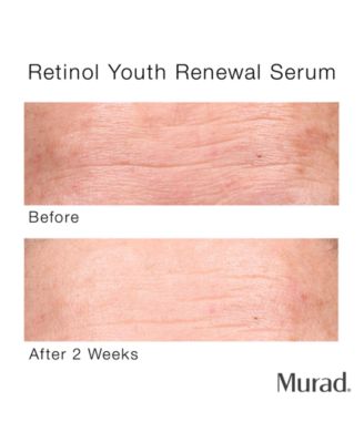 Murad Resurgence Retinol Youth Renewal Serum, 1-oz.