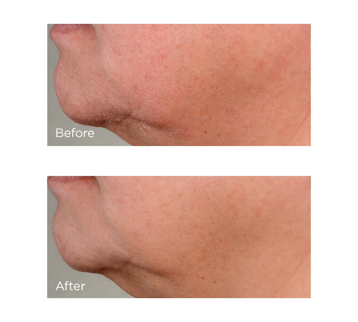 Perricone Md High Potency Growth Factor Firming & Lifting Serum