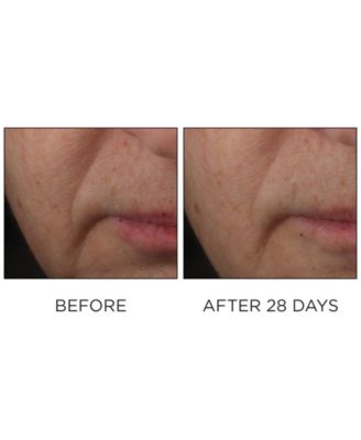 Cold Plasma Plus+ Advanced Serum Concentrate, 1 oz.