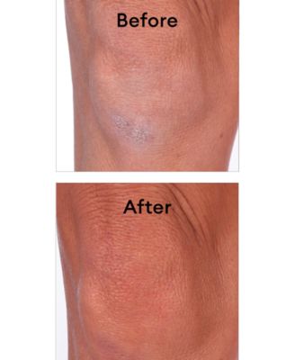 Thera Intensive Body Cream, 8.45-oz. 