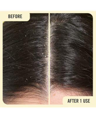 First Aid Beauty Anti-Dandruff Shampoo, 8-oz.