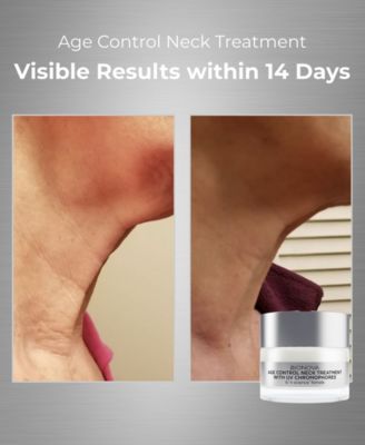 Neck Treatment With UV Chromophores
