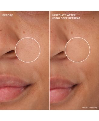 The POREfessional Deep Retreat Pore-Clearing Clay Mask