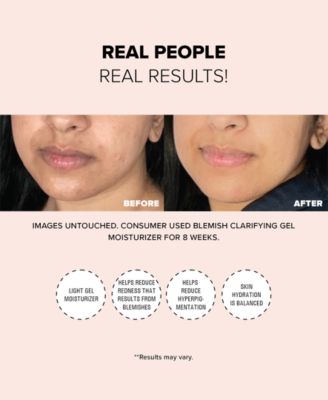 Nudeskin Blemish Clarifying Gel Moisturizer