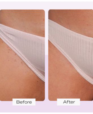 Ingrown Hair Pads With BHA & AHA, 60 pads 