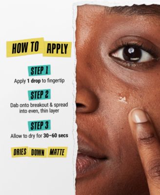 Truly Targeted Acne-Clearing Solution