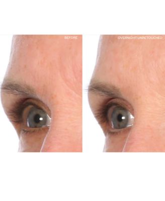 Mid-Browlift Pack, 2 Piece