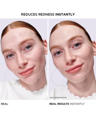 Bye Bye Redness Serum