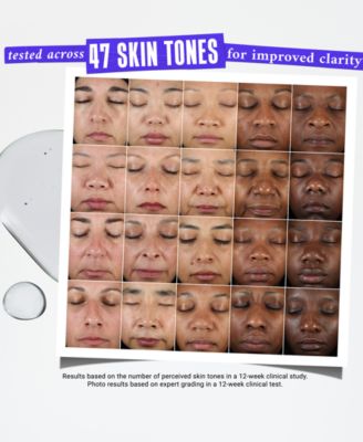 Dermatologist Solutions Clearly Corrective Dark Spot Solution, 3.4-oz.