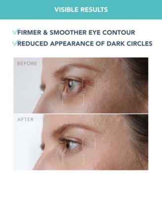 IRIS Firming PM Eye Serum, 15 ml