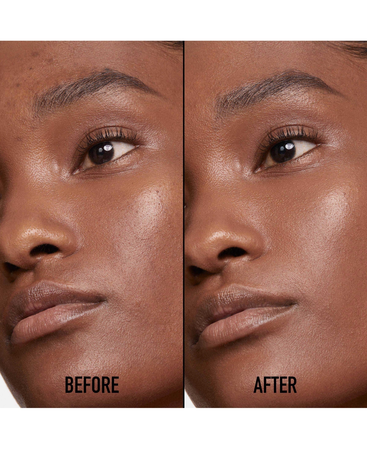 Dior Forever Skin Correct Full-coverage Concealer In 6,5 N Neutral (dark Skin With Neutral Be
