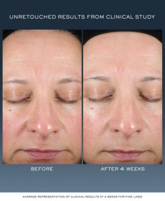 Lancôme  2-Pc. Advanced Génifique Skincare Set