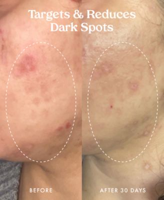 Star Bright Vitamin C Discoloration Correcting Serum, 1 oz.