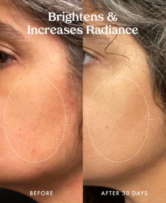 Star Bright Vitamin C Discoloration Correcting Serum, 1 oz.