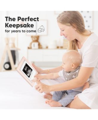 Solo Baby Sonogram Picture Frame, Modern Ultrasound Picture Frames, Pregnancy Announcements Sonogram Frame