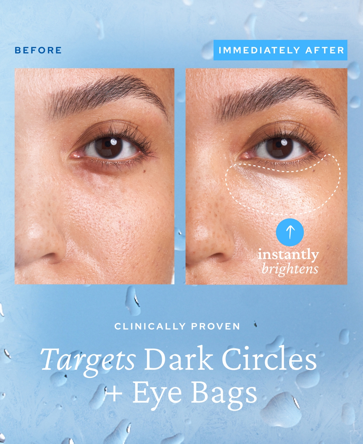 Belif Aqua Bomb Depuffing Eye Gel With Caffeine + Hyaluronic Acid 0.5 oz / 15 ml In No Color