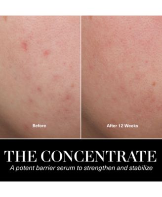 The Concentrate, 1 oz.