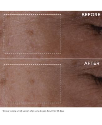 Clarins 5-Pc. Limited-Edition Double Serum & Super Restorative Skincare Set