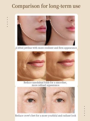 RF 5 In 1 EMS Micro Current LED Light Beauty Device