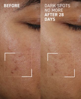 Dark Spots No More Triple Acid Spot Minimizing Concentrate, 0.5 oz.