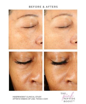 - The Pink Peptide Boost - Growth Factor Serum, 50 ml / 1.7 fl oz