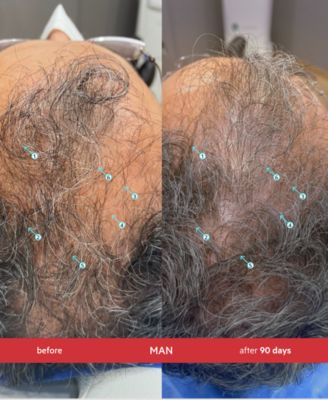 Spectral.DNC-S Extra Strength Anti-Gray Hair Density Serum, 2 oz.